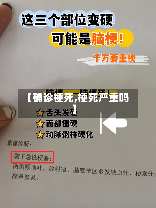 【确诊梗死,梗死严重吗】-第2张图片