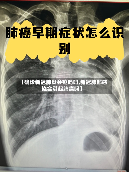 【确诊新冠肺炎会疼吗吗,新冠肺部感染会引起肺癌吗】-第2张图片