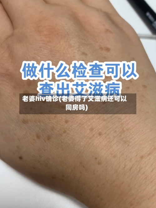 老婆hiv确诊(老婆得了艾滋病还可以同房吗)-第2张图片