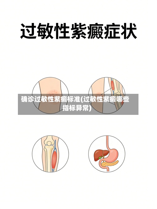 确诊过敏性紫癜标准(过敏性紫癜哪些指标异常)