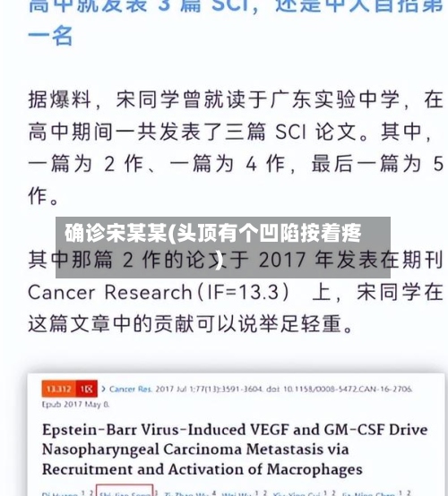 确诊宋某某(头顶有个凹陷按着疼)