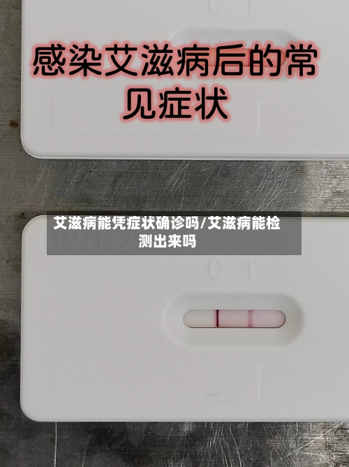 艾滋病能凭症状确诊吗/艾滋病能检测出来吗