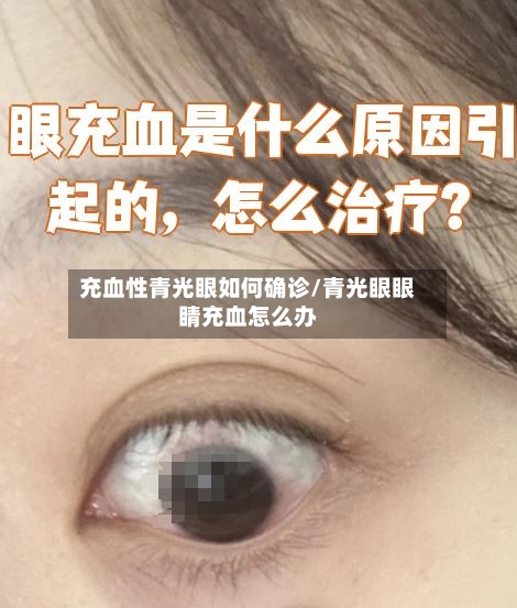 充血性青光眼如何确诊/青光眼眼睛充血怎么办