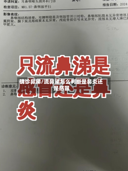 确诊鼻涕/流鼻涕怎么判断是鼻炎还是感冒