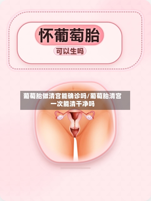 葡萄胎做清宫能确诊吗/葡萄胎清宫一次能清干净吗-第2张图片