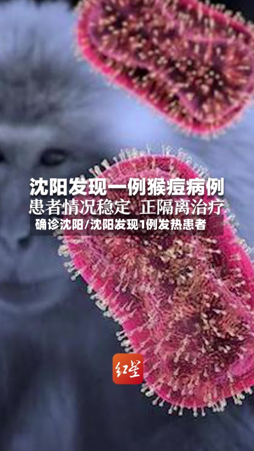 确诊沈阳/沈阳发现1例发热患者