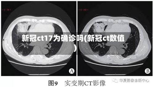新冠ct17为确诊吗(新冠ct数值)-第2张图片