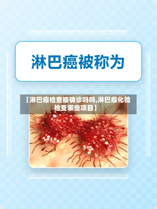 【淋巴瘤检查能确诊吗吗,淋巴瘤化验检查哪些项目】-第2张图片