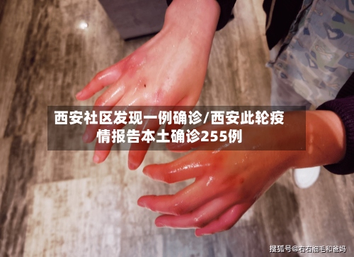 西安社区发现一例确诊/西安此轮疫情报告本土确诊255例