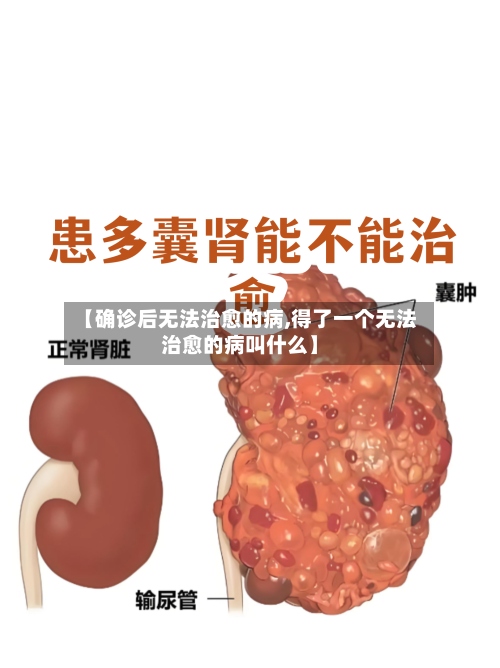 【确诊后无法治愈的病,得了一个无法治愈的病叫什么】-第2张图片