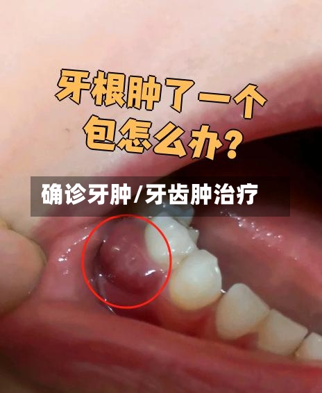 确诊牙肿/牙齿肿治疗-第2张图片
